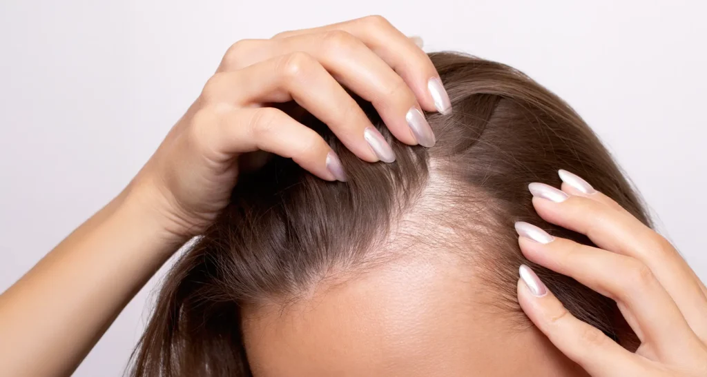 Beauty Aesthetic Treatments in North London by Dermesthetica -Post 1